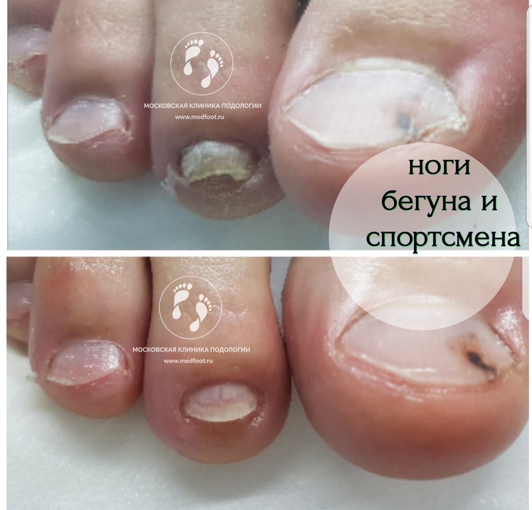 Спорт и Подология